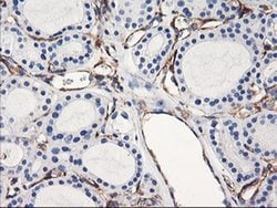 ENPEP Monoclonal Antibody (OTI3E7), TrueMAB , OriGene 30 &mu;L; Unconjugated:Antibodies,