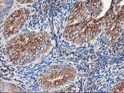 ENPEP Monoclonal Antibody (OTI3E7), TrueMAB , OriGene 30 &mu;L; Unconjugated:Antibodies,