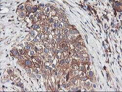 ENPEP Monoclonal Antibody (OTI3E7), TrueMAB , OriGene 30 &mu;L; Unconjugated:Antibodies,