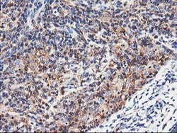 ENPEP Monoclonal Antibody (OTI3E7), TrueMAB , OriGene 30 &mu;L; Unconjugated:Antibodies,