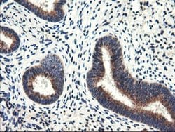 ENPEP Monoclonal Antibody (OTI1C4), TrueMAB , OriGene:Antibodies:Primary