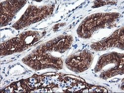 ENPEP Monoclonal Antibody (OTI1C4), TrueMAB , OriGene:Antibodies:Primary