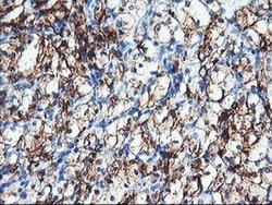 ENPEP Monoclonal Antibody (OTI1C4), TrueMAB , OriGene 30 &mu;L; Unconjugated:Antibodies,