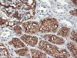 ENPEP Monoclonal Antibody (OTI1D4), TrueMAB , OriGene 100 &mu;L; Unconjugated:Antibodies,