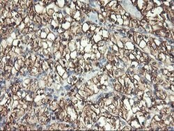 ENPEP Monoclonal Antibody (OTI1D4), TrueMAB , OriGene 100 &mu;L; Unconjugated:Antibodies,