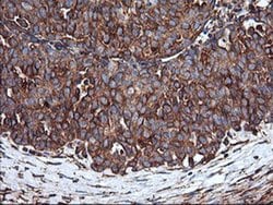 ENPEP Monoclonal Antibody (OTI3G1), TrueMAB , OriGene 100 &mu;L; Unconjugated:Antibodies,