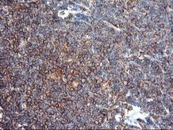 ENPEP Monoclonal Antibody (OTI3G1), TrueMAB , OriGene 100 &mu;L; Unconjugated:Antibodies,