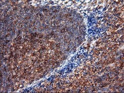 ENPEP Monoclonal Antibody (OTI3G1), TrueMAB , OriGene 100 &mu;L; Unconjugated:Antibodies,