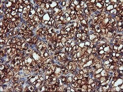 ENPEP Monoclonal Antibody (OTI3G1), TrueMAB , OriGene 100 &mu;L; Unconjugated:Antibodies,