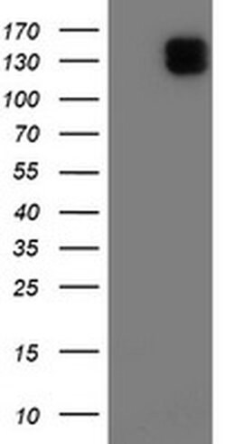 ENPEP Monoclonal Antibody (OTI1D1), TrueMAB , OriGene 100 &mu;L; Unconjugated:Antibodies,