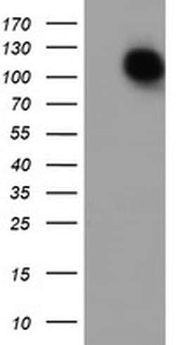 ENPEP Monoclonal Antibody (OTI1C4), TrueMAB , OriGene 30 &mu;L; Unconjugated:Antibodies,