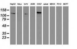 ENPEP Monoclonal Antibody (OTI1D4), TrueMAB , OriGene 100 &mu;L; Unconjugated:Antibodies,