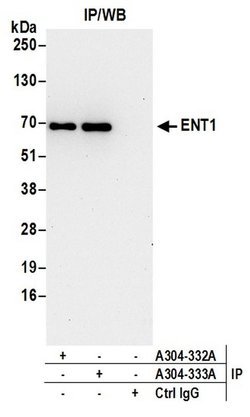 ENT1 Rabbit anti-Human, Polyclonal, Bethyl Laboratories 100 &mu;L; Unconjugated:Antibodies,