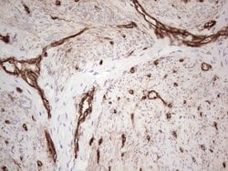 ENTPD1 Mouse anti-Human, Clone: OTI2B10, lyophilized, TrueMAB 100 &mu;g;