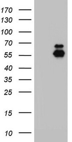 ENTPD1 Monoclonal Antibody (OTI9D10), TrueMAB , OriGene:Antibodies:Primary