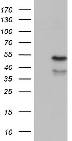 ENTPD1 Monoclonal Antibody (OTI2A1), TrueMAB , OriGene 100 &mu;L; Unconjugated:Antibodies,