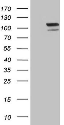 EPAS1 Monoclonal Antibody (OTI6G3), TrueMAB , OriGene 100 &mu;L; Unconjugated:Antibodies,