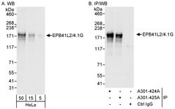 EPB41L2/4.1G Rabbit anti-Human, Polyclonal, Bethyl Laboratories 100 &mu;L;