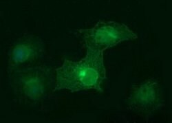 EPCAM Mouse anti-Human, Clone: OTI1D4, lyophilized, TrueMAB 100 &mu;g;