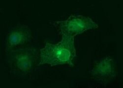 EPCAM Monoclonal Antibody (OTI1D4), TrueMAB , OriGene:Antibodies:Primary