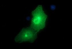 EPCAM Monoclonal Antibody (OTI2B8), TrueMAB , OriGene:Antibodies:Primary