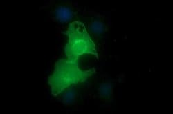 EPCAM Monoclonal Antibody (OTI2B6), TrueMAB , OriGene:Anticuerpos:Anticuerpos