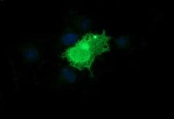 EPCAM Monoclonal Antibody (OTI3B2), TrueMAB , OriGene:Antibodies:Primary