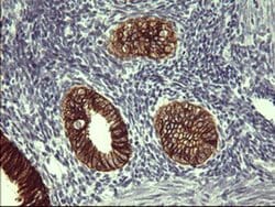 EPCAM Monoclonal Antibody (OTI2D7), TrueMAB , OriGene 100 &mu;L; Unconjugated:Antibodies,