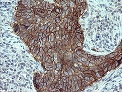 EPCAM Monoclonal Antibody (OTI2B4), TrueMAB , OriGene 100 &mu;L; Unconjugated:Antibodies,