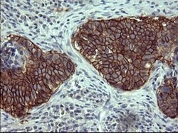 EPCAM Monoclonal Antibody (OTI1E9), TrueMAB , OriGene:Antibodies:Primary