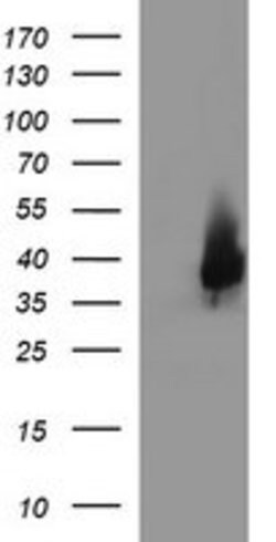 EPCAM Mouse anti-Human, Clone: OTI1D4, lyophilized, TrueMAB 100 &mu;g;