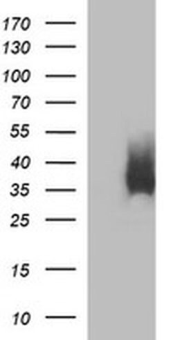EPCAM Monoclonal Antibody (OTI2B1), TrueMAB , OriGene 100 &mu;L; Unconjugated:Antibodies,