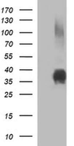 EPCAM Monoclonal Antibody (OTI2D7), TrueMAB , OriGene:Antibodies:Primary