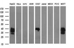 EPCAM Monoclonal Antibody (OTI2D7), TrueMAB , OriGene 100 &mu;L; Unconjugated:Antibodies,