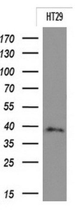 EPCAM Monoclonal Antibody (OTI2B8), TrueMAB , OriGene:Antibodies:Primary