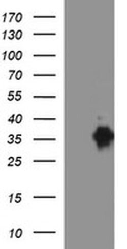 EPCAM Monoclonal Antibody (OTI2A3), TrueMAB , OriGene 30 &mu;L; Unconjugated:Antibodies,