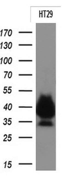 EPCAM Monoclonal Antibody (OTI2B6), TrueMAB , OriGene 30 &mu;L | Buy Online | Origene Technologies | Fisher Scientific