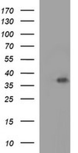 EPCAM Monoclonal Antibody (OTI2G9), TrueMAB , OriGene 30 &mu;L; Unconjugated:Antibodies,