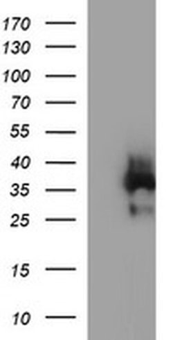 EPCAM Monoclonal Antibody (OTI2E6), TrueMAB , OriGene 100 &mu;L; Unconjugated:Antibodies,