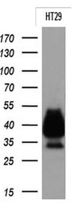 EPCAM Monoclonal Antibody (OTI2E6), TrueMAB , OriGene 100 &mu;L; Unconjugated:Antibodies,