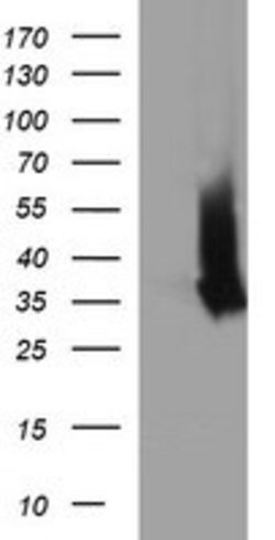EPCAM Mouse anti-Human, Clone: OTI2B4, lyophilized, TrueMAB 100 &mu;g;