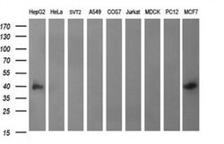 EPCAM Monoclonal Antibody (OTI2B4), TrueMAB , OriGene:Antibodies:Primary