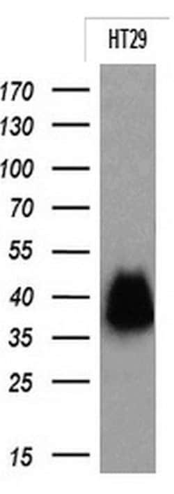 EPCAM Monoclonal Antibody (OTI2B4), TrueMAB , OriGene:Antibodies:Primary