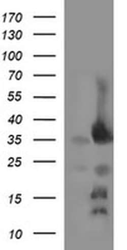 EPCAM Monoclonal Antibody (OTI3B2), TrueMAB , OriGene 100 &mu;L; Unconjugated:Antibodies,