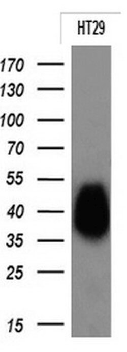 EPCAM Monoclonal Antibody (OTI3G2), TrueMAB , OriGene 100 &mu;L | Buy Online | Origene Technologies | Fisher Scientific