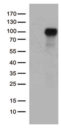 EPHA1 Monoclonal Antibody (OTI2D6), TrueMAB , OriGene:Antibodies:Primary