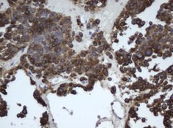 EPHX1 Monoclonal Antibody (OTI4G4), TrueMAB , OriGene 100 &mu;L | Buy Online | Origene Technologies | Fisher Scientific