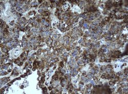 EPHX1 Monoclonal Antibody (OTI2D8), TrueMAB , OriGene 100 &mu;L; Unconjugated:Antibodies,
