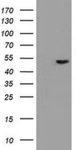 EPHX1 Monoclonal Antibody (OTI4G4), TrueMAB , OriGene 100 &mu;L | Buy Online | Origene Technologies | Fisher Scientific