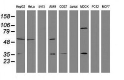 EPHX1 Monoclonal Antibody (OTI4G4), TrueMAB , OriGene 100 &mu;L | Buy Online | Origene Technologies | Fisher Scientific